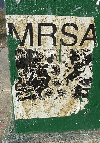 "MRSA" by silverfuture is licensed under CC BY-NC-SA 2.0